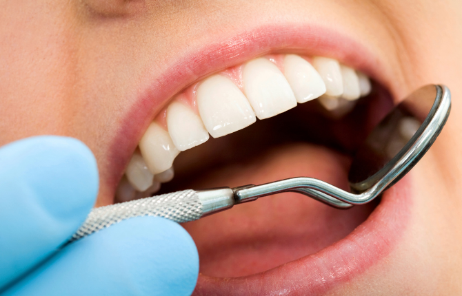 Czym jest lakowanie zębów?